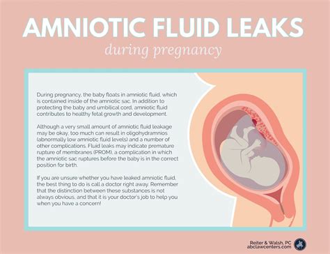 how to tell if leaking amniotic fluid|Leaking Amniotic Fluid: How to Tell